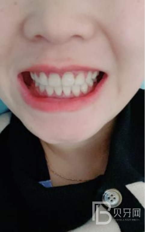 網(wǎng)友親身經(jīng)歷，齒康口腔做牙齒矯正怎么樣？靠譜嘛？