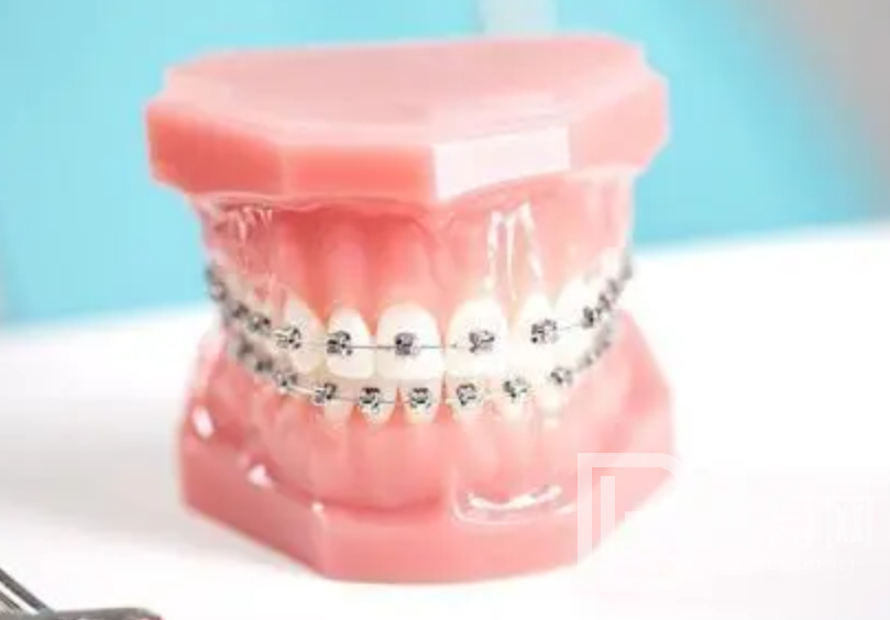 牙齒矯正為什么那么貴，牙齒矯正貴的原因是什么？