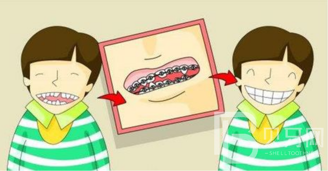 孩子牙齒不齊可以做牙齒矯正嗎？