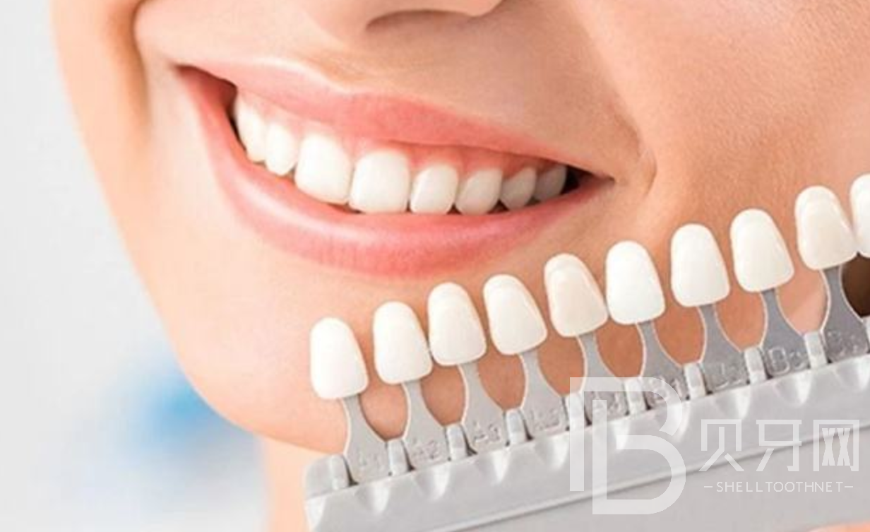 有沒有靠譜的牙齒美白方法？