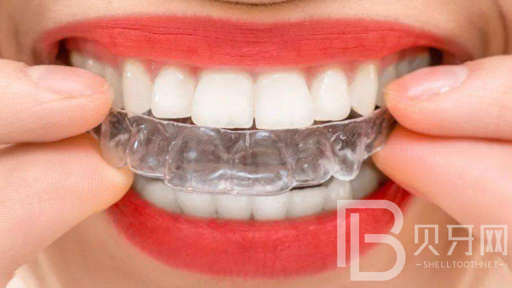 怎么讓牙齒變整齊又好看，三種常見方法了解一下