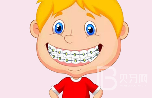 上海做牙齒矯正醫(yī)院哪家好?來這5家牙科做矯正不踩坑