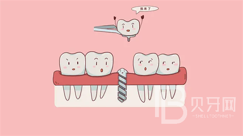 上海華齒口腔做牙收費貴嗎？看看診療價格這幾項很便宜！