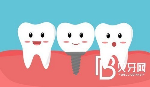 上海黃浦區(qū)種植牙價格表，種牙好又便宜的牙科