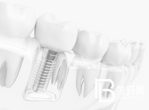 盤點(diǎn)北京牙齒矯正好口碑醫(yī)院，這幾家值得一去！