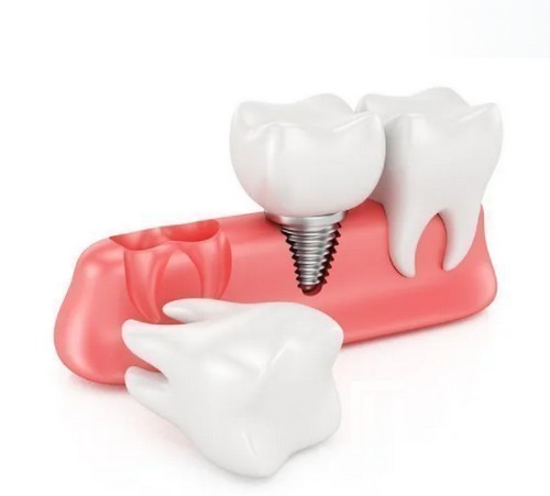 上海永華口腔門(mén)診部?jī)r(jià)格表公開(kāi)，老牌醫(yī)院收費(fèi)并不貴！