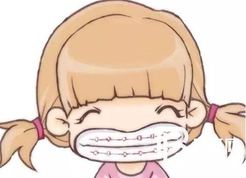 上海鑫齒口腔牙齒矯正好嗎？時(shí)代天使和隱適美有效果差別嗎？