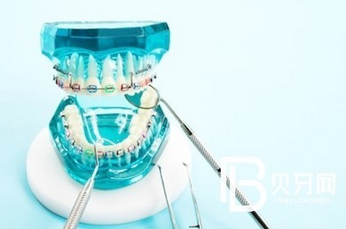 北京中諾口腔醫(yī)院靠譜不？中諾口腔牙齒矯正費(fèi)用高嗎？