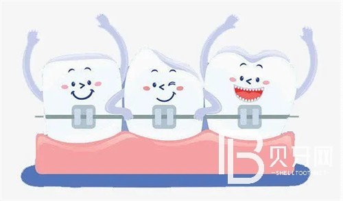 北京圣貝口腔牙齒矯正多少錢？你想了解的價格這里都有！