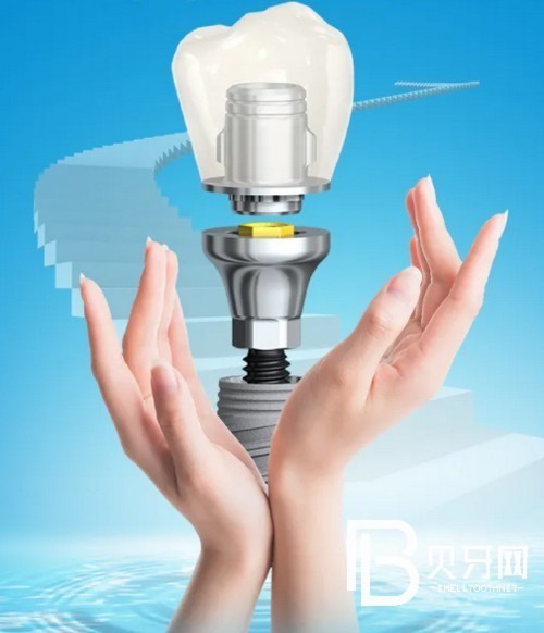 北京中諾口腔醫(yī)院正規(guī)嗎？中諾口腔醫(yī)院種植牙怎么樣？