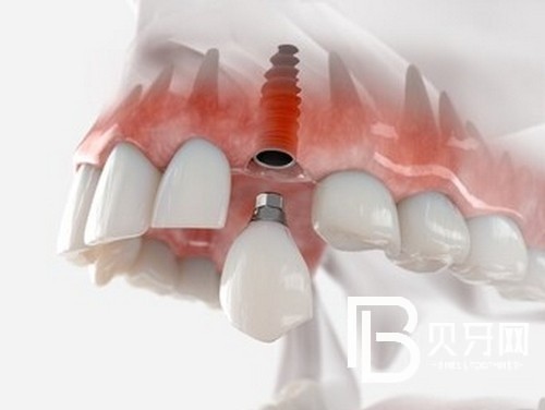 北京京一口腔怎么樣？醫(yī)院簡介優(yōu)勢項目統(tǒng)統(tǒng)都有！