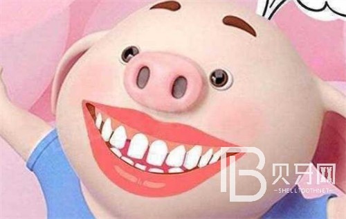 上海圣貝口腔牙齒矯正怎么樣？真實(shí)牙友口碑揭秘！