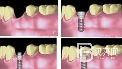 北京固爾口腔怎么樣？收費怎么樣？