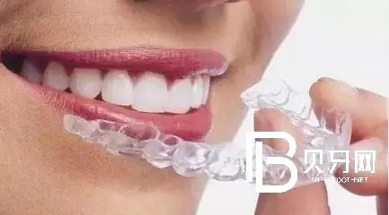 上海正?？谇徽?guī)嗎？牙齒矯正技術(shù)怎么樣？地址在哪？