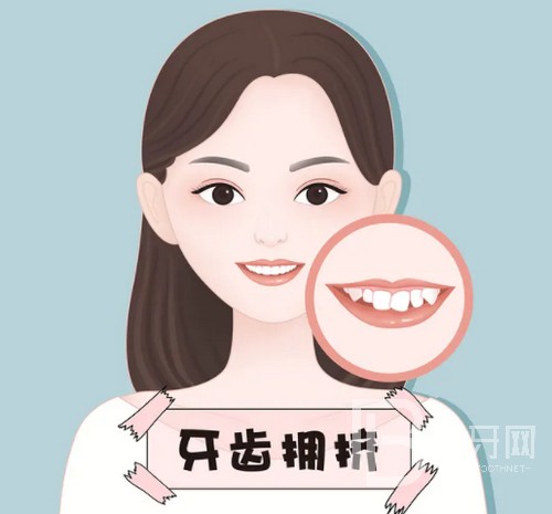 北京牙齒矯正大概要花費多少錢？公布2022年北京牙齒矯正價目表