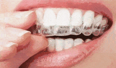 北京中諾口腔醫(yī)院種植牙技術好的醫(yī)院，好口碑不是空穴來風