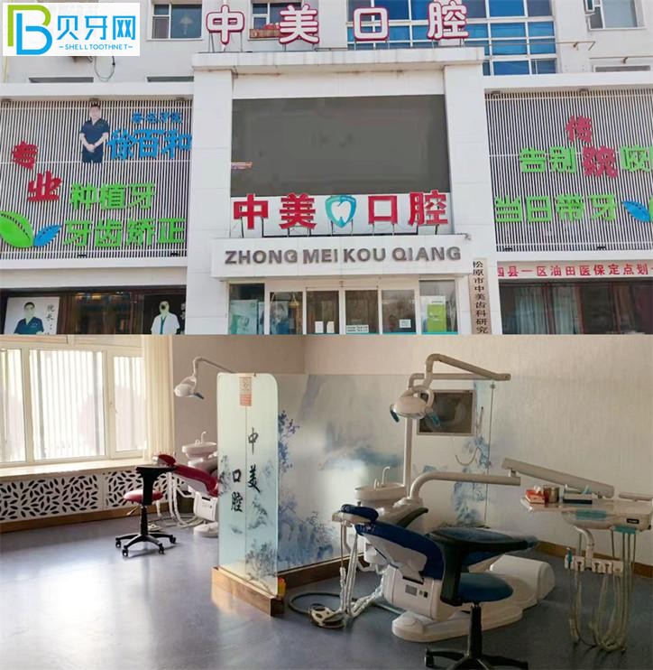 吉林松原中美口腔怎么樣 性價(jià)比很高正畸種牙很香