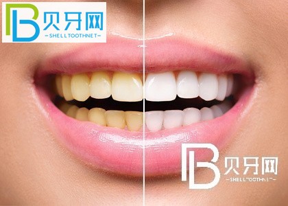 上海瑞爾齒科怎么樣？口碑如何？附上海各門(mén)店地址