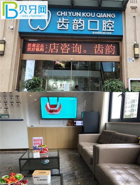 深圳齒韻口腔收費(fèi)標(biāo)準(zhǔn)