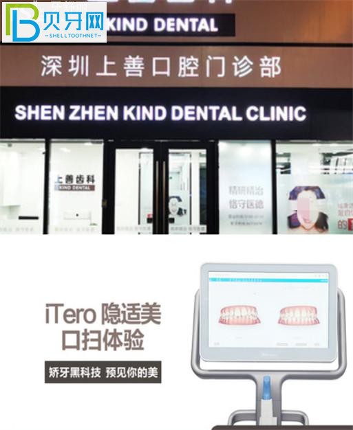 深圳上善齒科收費(fèi)標(biāo)準(zhǔn)價(jià)格表