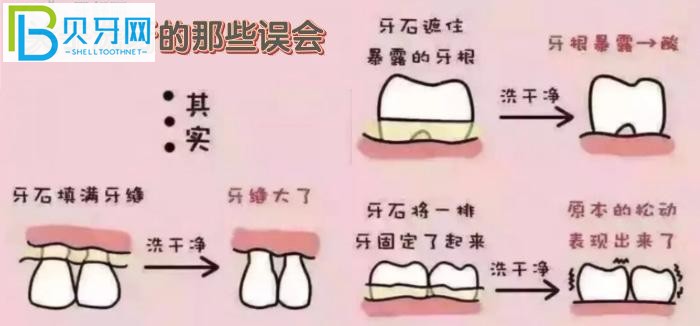 萬州牙科醫(yī)院哪里好？推薦品善和牙博士兩家口碑好的牙科診所給你！