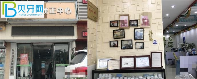 衡陽寶島口腔矯正價格