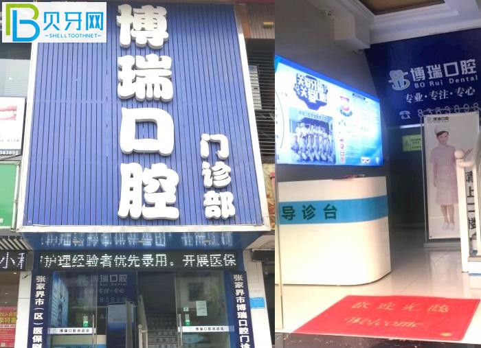 想找張家界口腔科比較好的醫(yī)院?來看博瑞口腔口碑怎么樣?