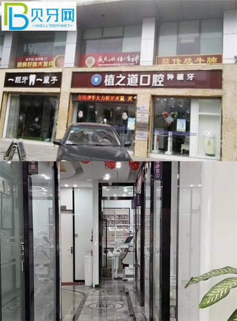 海口植之道口腔種牙怎么樣