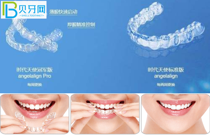 珠海隱形牙套哪家醫(yī)院比較好?推薦暨博口腔技術(shù)好價(jià)不高!