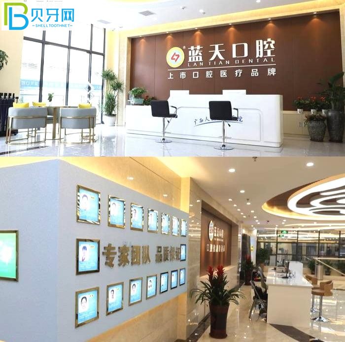 玉林口腔醫(yī)院哪個好?當?shù)卦u價藍天口腔醫(yī)院正規(guī)靠譜技術(shù)好