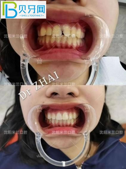 沈陽米蘭口腔門診部口碑好不好