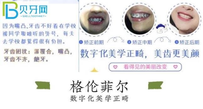 深圳格倫菲爾口腔好評(píng)多嗎