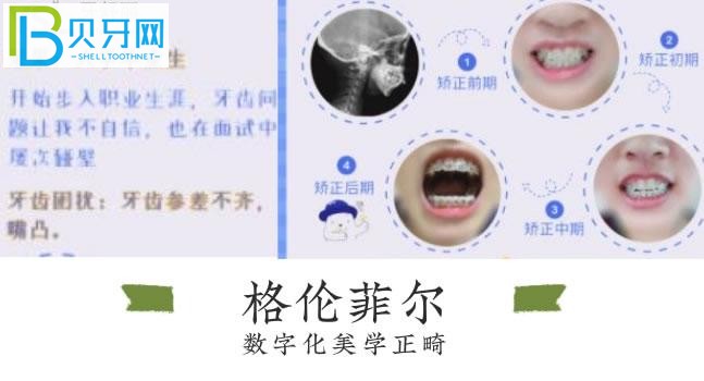 深圳格倫菲爾口腔好評(píng)多嗎