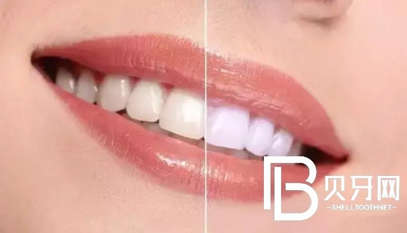 武漢雅貝康口腔怎么樣？醫(yī)生實(shí)力如何？