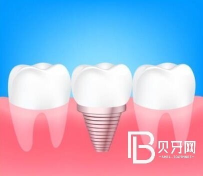 杭州博泰口腔口碑怎么樣？醫(yī)院正規(guī)嗎？