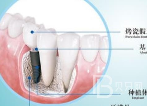 廣州優(yōu)德口腔正規(guī)靠譜嗎？廣州優(yōu)德口腔醫(yī)院位置在哪？