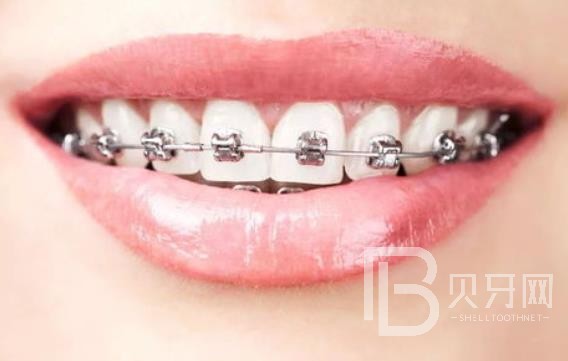 廣州明瑞口腔怎么樣？廣州明瑞口腔口碑好不好？廣州明瑞口腔種植牙多少錢