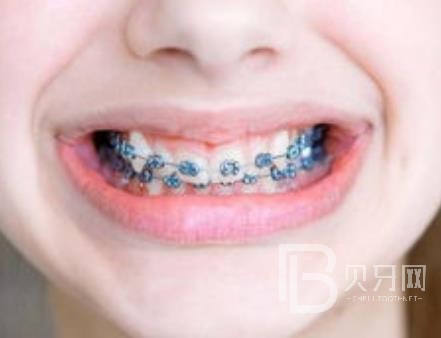 廣州團(tuán)圓口腔怎么樣？廣州團(tuán)圓口腔種植牙一顆多少錢