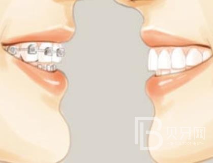 廣州雅皓口腔正規(guī)靠譜嗎？廣州雅皓口腔醫(yī)院位置在哪？