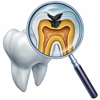 杭州種植一顆假牙多少錢！杭州張永珍口腔診所種植牙價(jià)格表參考，瑞典諾貝爾Active種植牙：13390元起/顆！