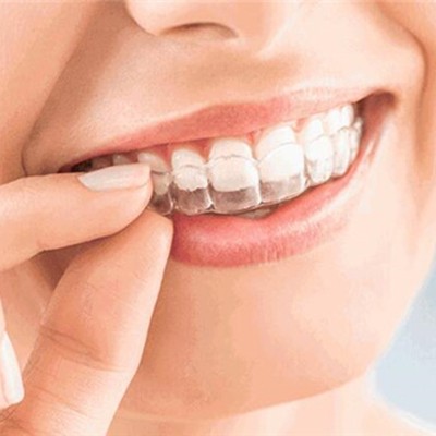 杭州深覆合矯正排名前十的口腔醫(yī)院，浙江富陽康順口腔實(shí)力優(yōu)勢盡顯！