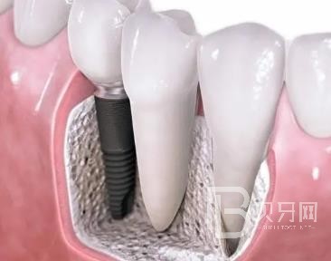 廣州牙美佳口腔正規(guī)靠譜嗎？廣州牙美佳口腔醫(yī)院位置在哪？