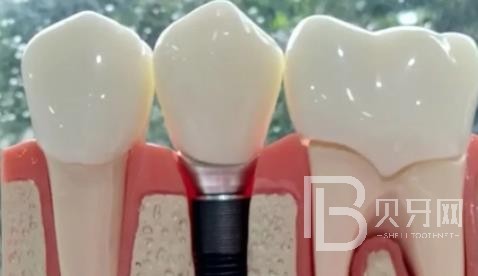 廣州華晨口腔正規(guī)靠譜嗎？廣州華晨口腔醫(yī)院位置在哪？