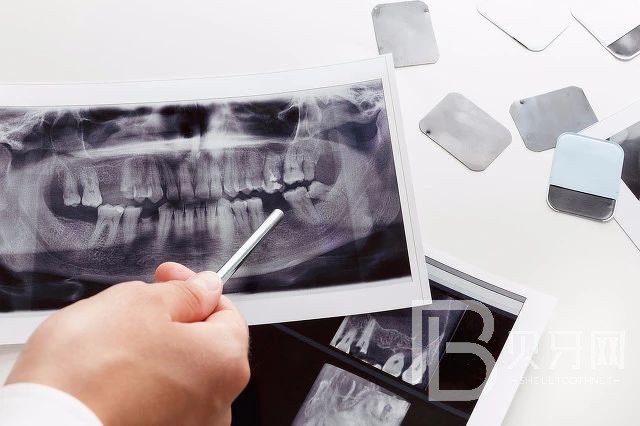 到底種植牙好還是鑲牙好？北京王府井口腔怎么樣？