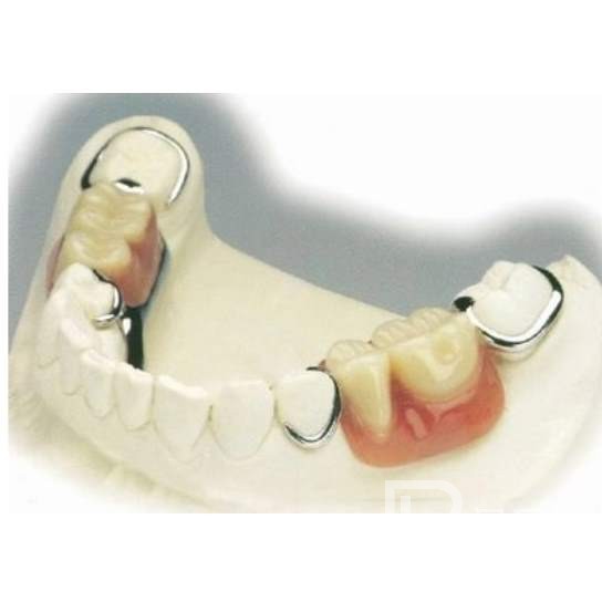 杭州種植一顆假牙多少錢！杭州潔奧口腔門診部(蕭山區(qū))種植牙價(jià)格表更新，國(guó)產(chǎn)康盛種植牙價(jià)格：3836元起/顆！