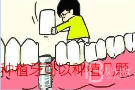 allon6種植牙是什么意思？東莞拜爾口腔