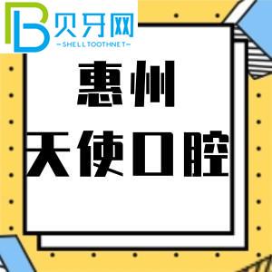 惠州天使口腔門診怎么樣？市民說活動價格不貴。